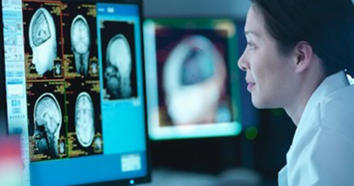 Healthcare worker looking at brain imaging on monitor