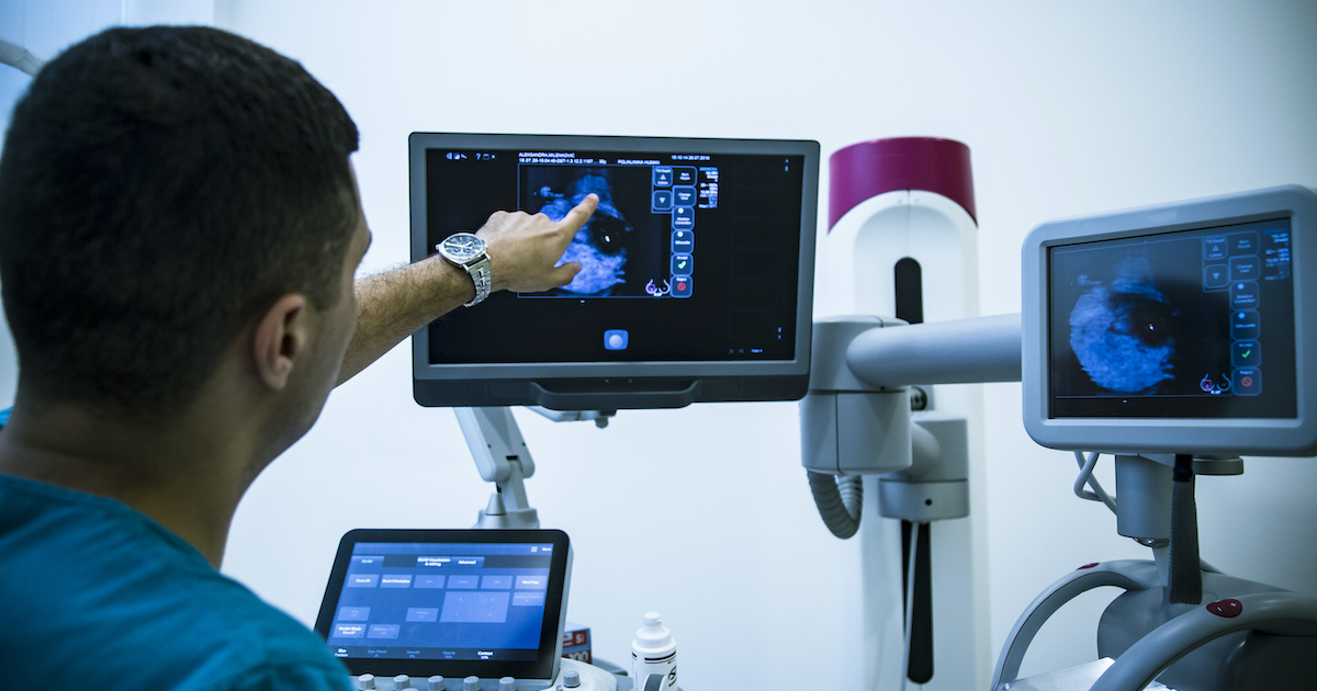 Doctor looking at mammogram