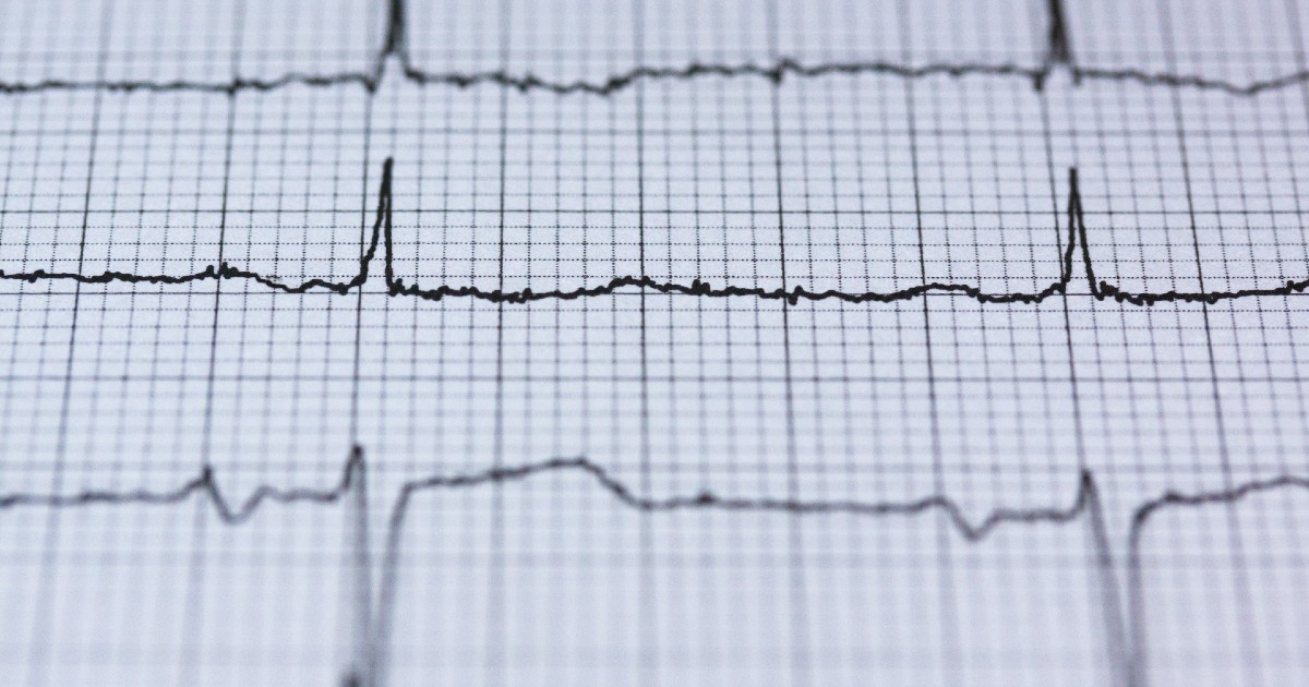 An EKG readout