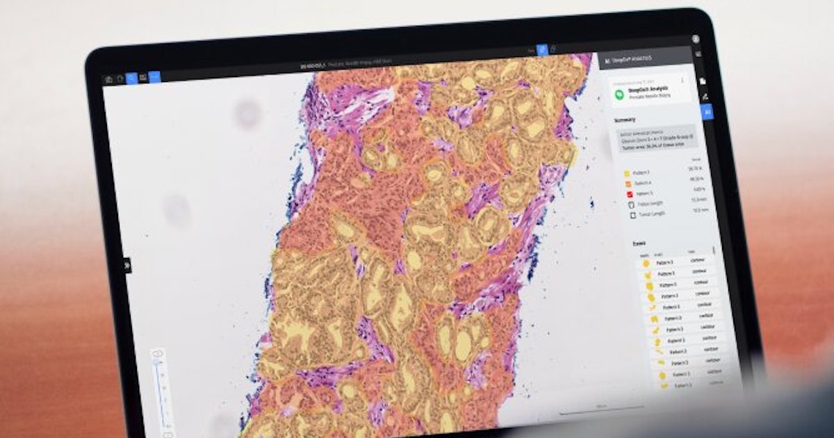 A laptop screen showing the DeepDx Prostate Pro panel
