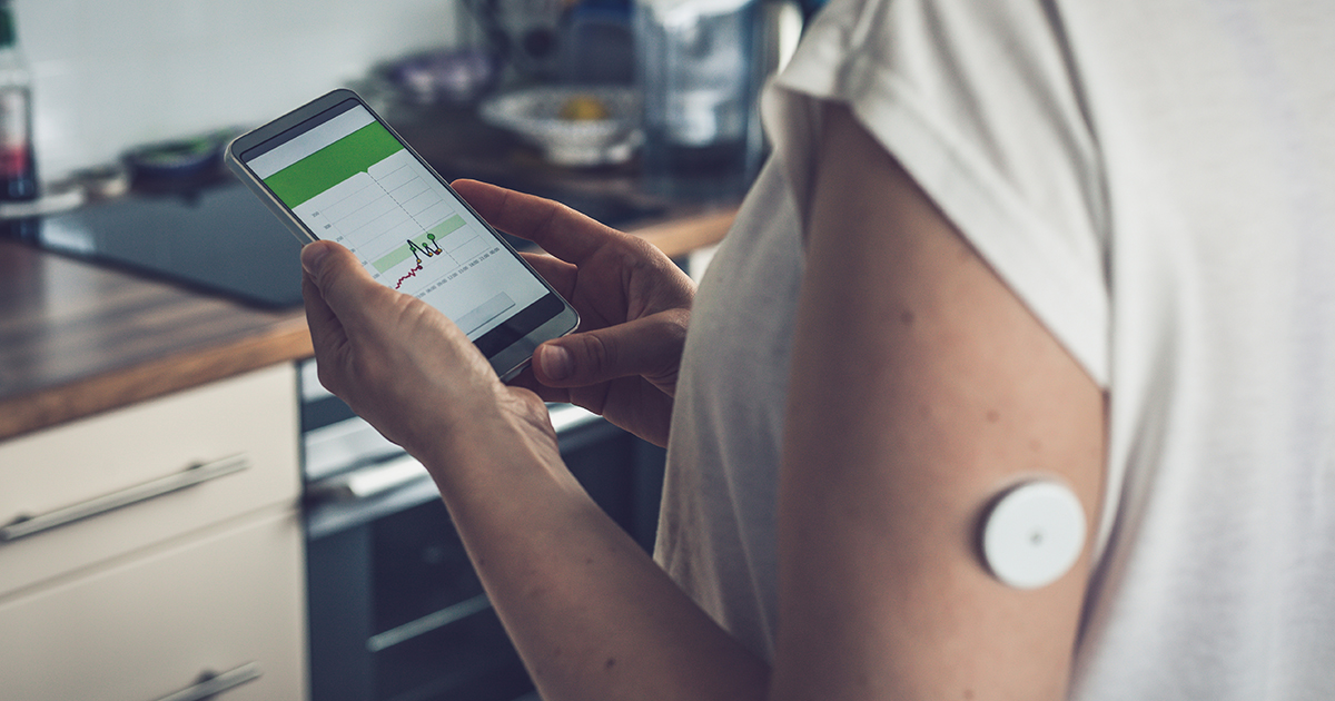 Remote patient monitoring for acute care at home