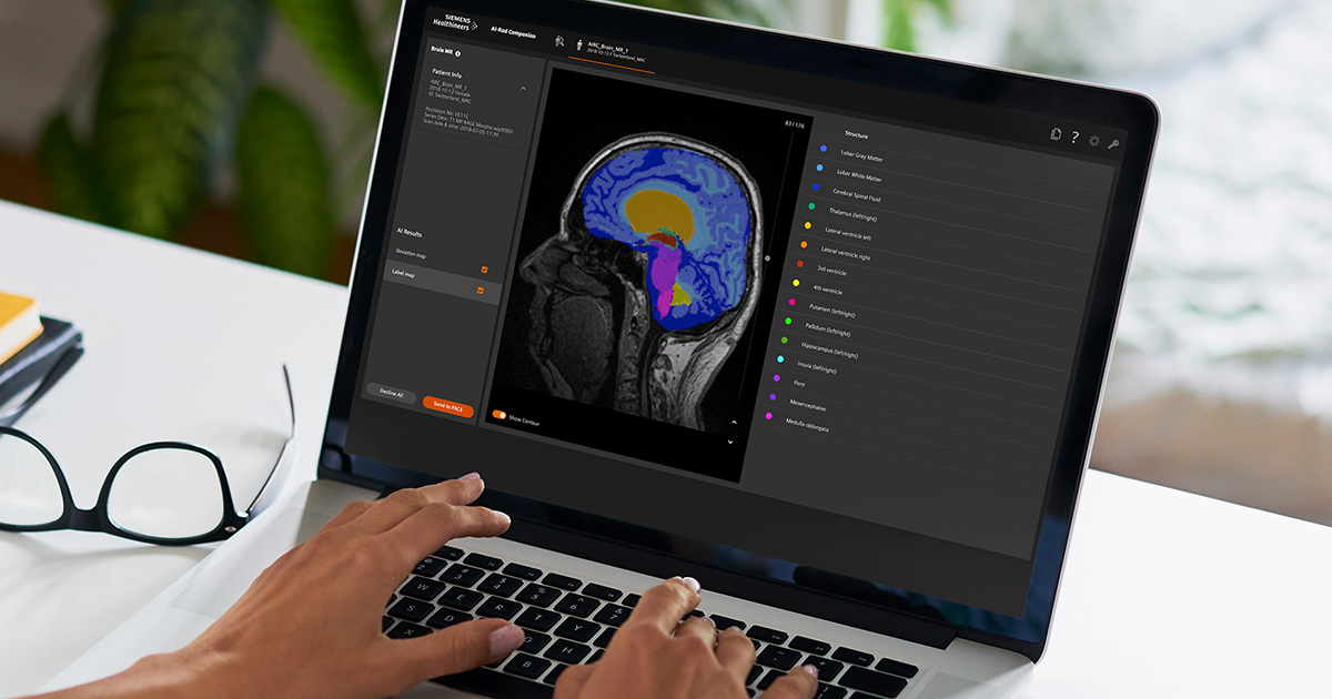 AI-Rad screen on latptop