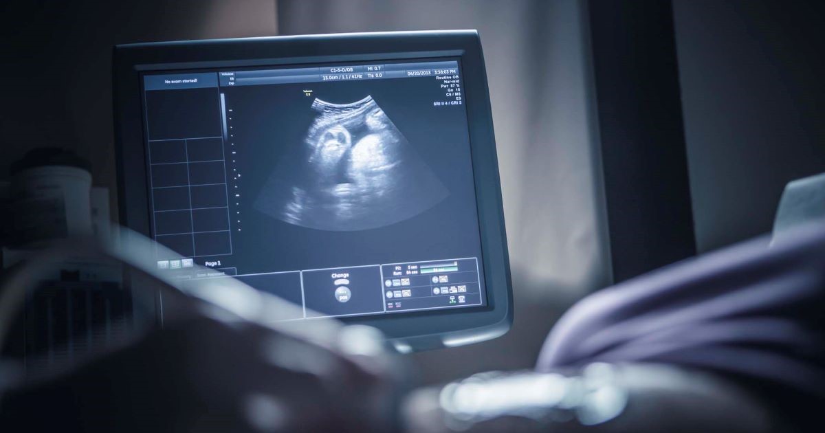 Sonogram on screen
