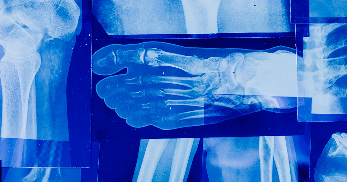 X-Ray images