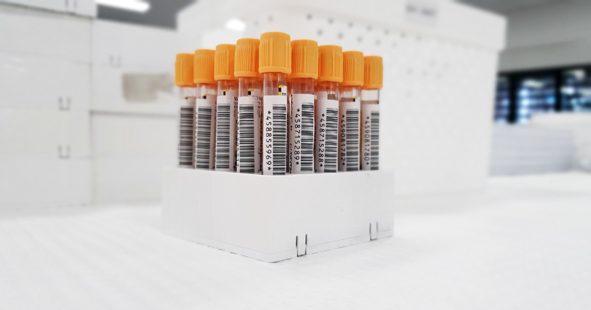 Vials for blood tests
