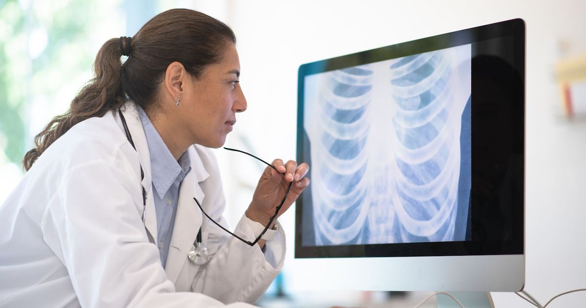 Doctor looking at chest x-ray