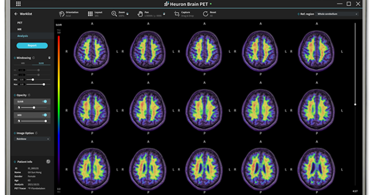 Interface of Heuron Brain PET by South Korean company Heuron