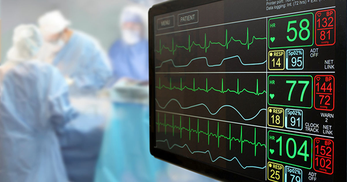 A monitor in the foreground and three surgeons appear in the background.