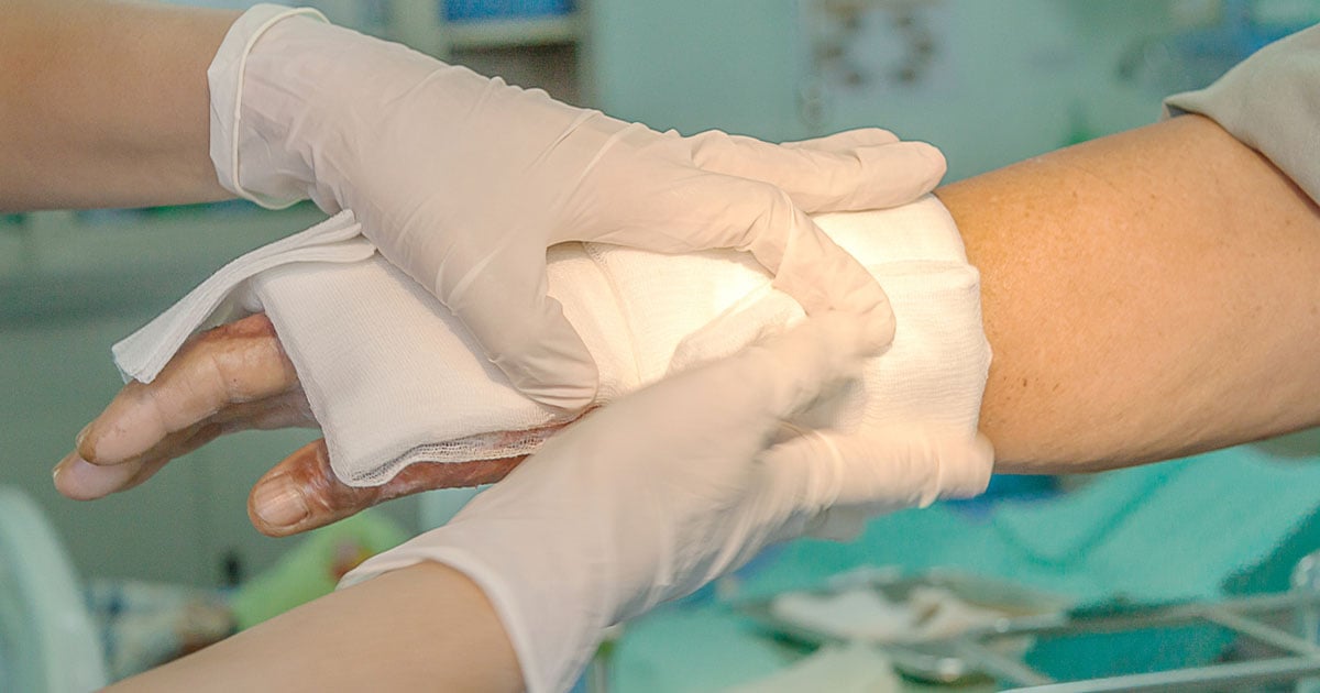 Hands in surgical gloves cover a burn on a patients hand in the hospital.
