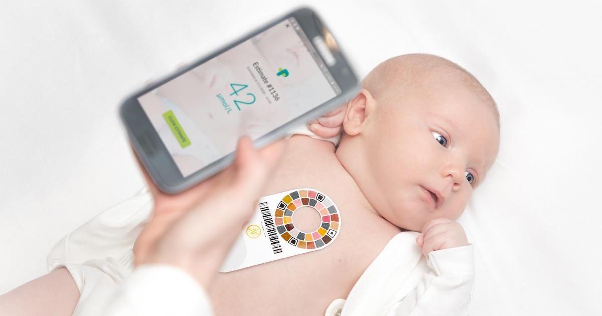 Measuring a baby's bilirubin levels using the Picterus Jaundice Pro app