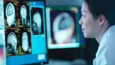 Healthcare worker looking at brain imaging on monitor