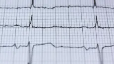 EKG read out