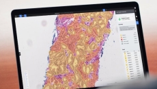 A laptop screen showing the DeepDx Prostate Pro panel