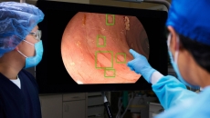 An AI-assisted colorectal screening tool used at Farrer Park Hospital