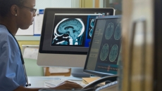 Radiologist looks at PACS monitor