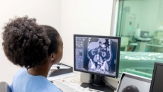 Healthcare worker looking at x-ray image on monitor