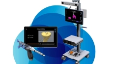 BLK Max's Robotic System for Joint Replacement
