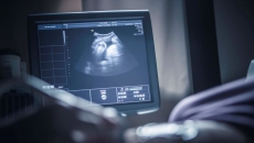 Sonogram on screen