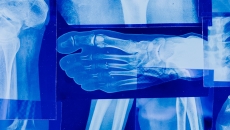 X-Ray images