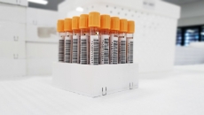 Vials for blood tests