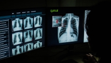 Qure.ai's qXR software