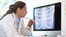 Doctor looking at chest x-ray
