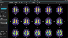 Interface of Heuron Brain PET by South Korean company Heuron