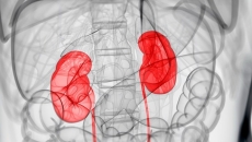 Kidneys showing up as red on an otherwise black-and-white X-ray