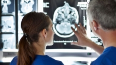 Doctors assessing a brain scan
