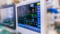 A computer monitor used in a heart surgery
