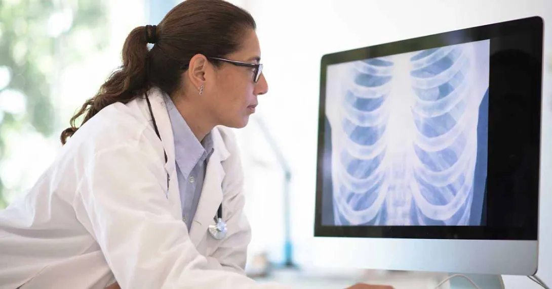 Doctor looking at an X-ray on a computer screen Doctor looking at an X-ray on a computer screen