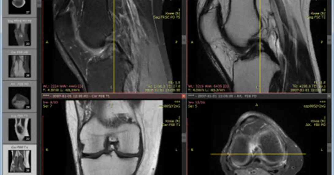 Body scans