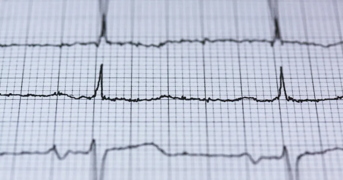 An EKG readout
