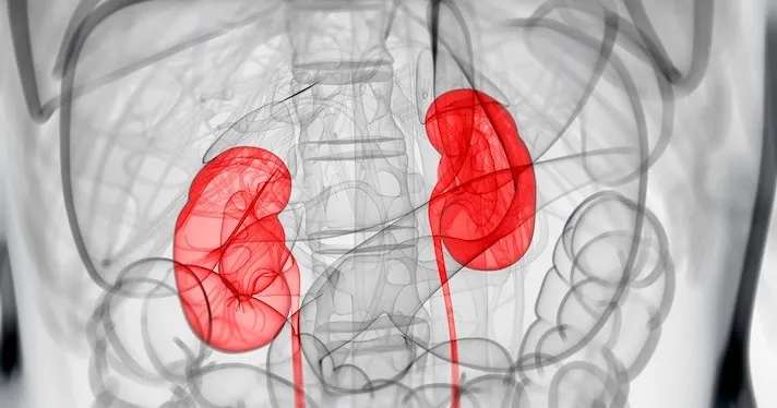 Kidneys showing up as red on an otherwise black-and-white X-ray