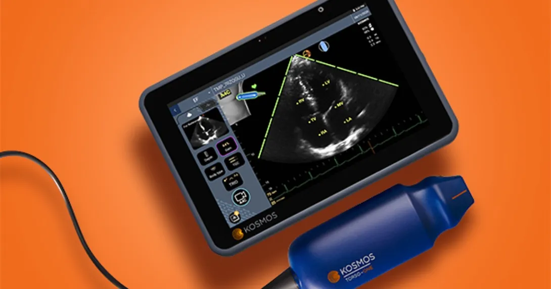 A handheld point-of-care ultrasound