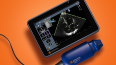 A handheld point-of-care ultrasound